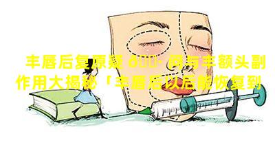 丰唇后复原疑 🕷 问与丰额头副作用大揭秘「丰唇后以后能恢复到以前 🦊 吗」